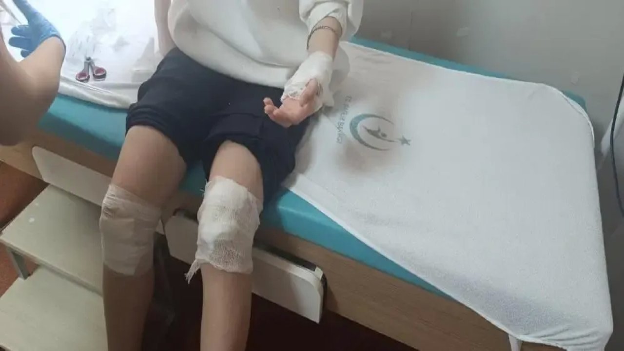 Elazığ'da Sokak Köpekleri Genç Kız Yaralandı